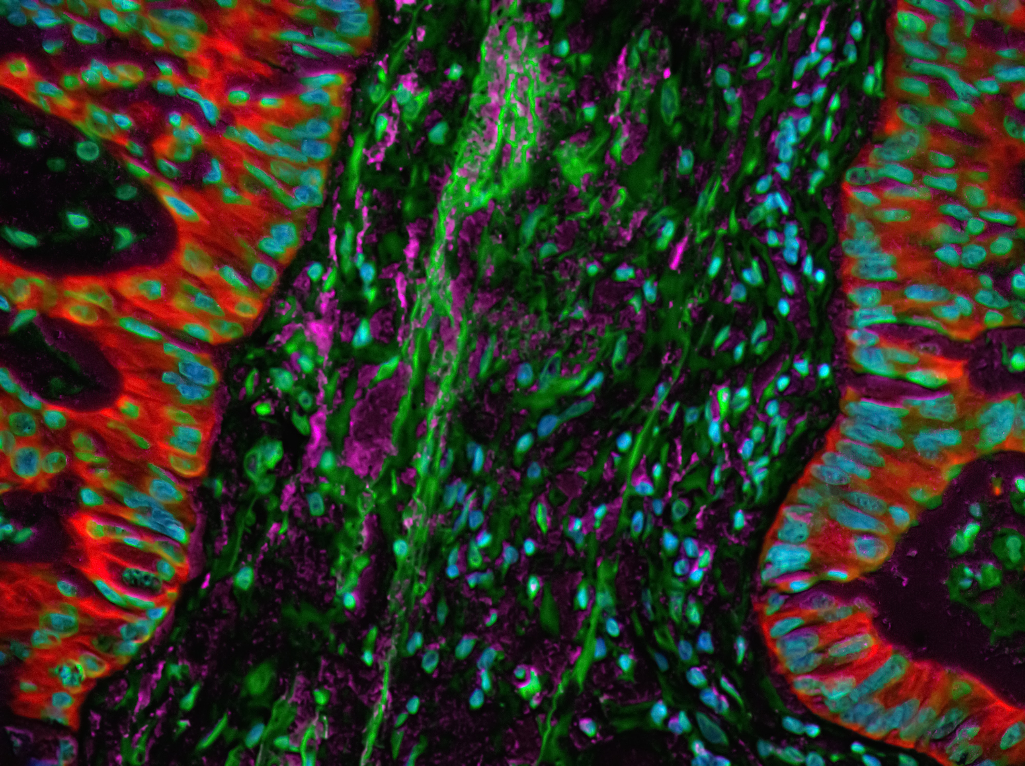 Multiplex fluorescence microscopy image of colon tissue
