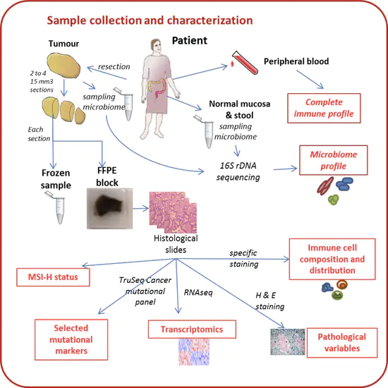 Colobiome: Tumour-adjacent microbiome and immune profile of tumour in the context of heterogeneity and aggressivness of colorectal cancer